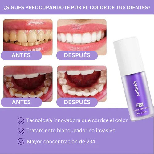 Blanqueador Dental V34™ - TRENDFINDER® (2025)